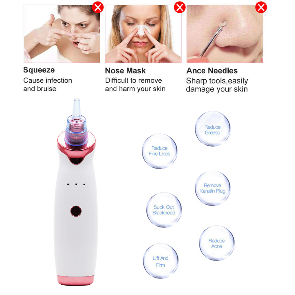 Blackhead Remover Pore Vacuum Cleaner Electric USB Pore Vacuum with 5