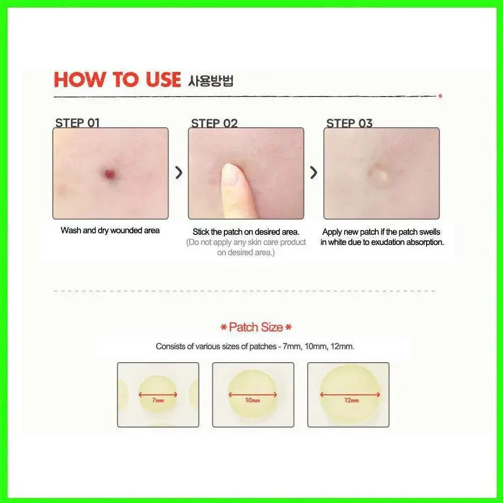 24pcs Face Acne Pimple Spot Facial Skin Care Blackhead Removal Freckle