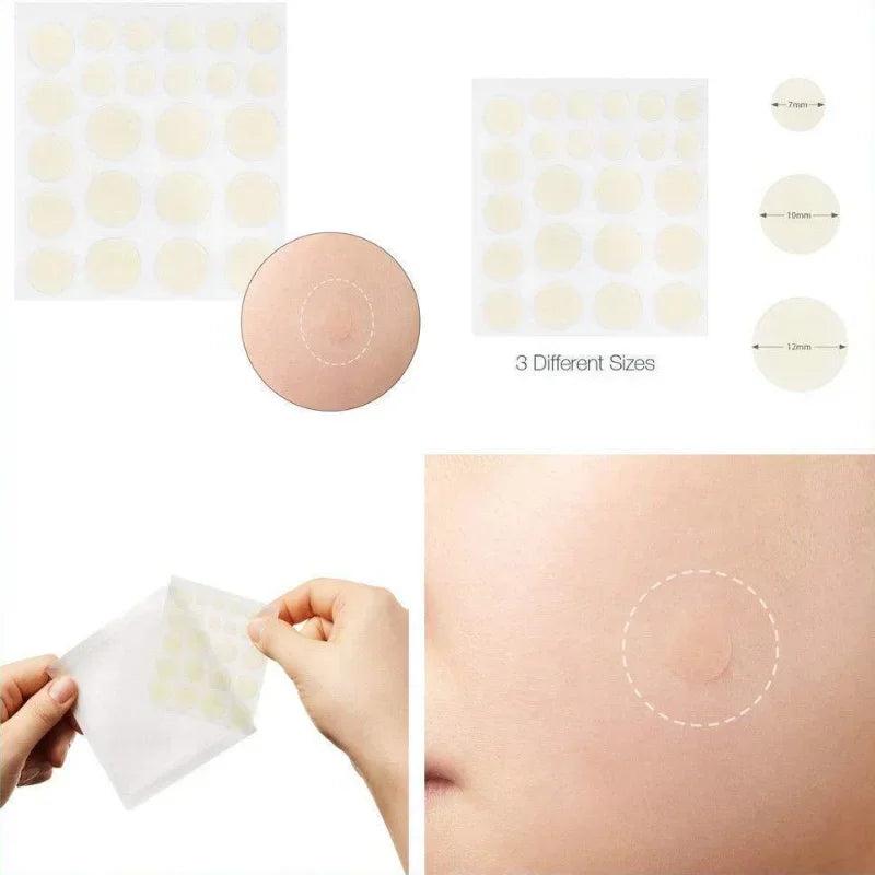 24pcs Face Acne Pimple Spot Facial Skin Care Blackhead Removal Freckle